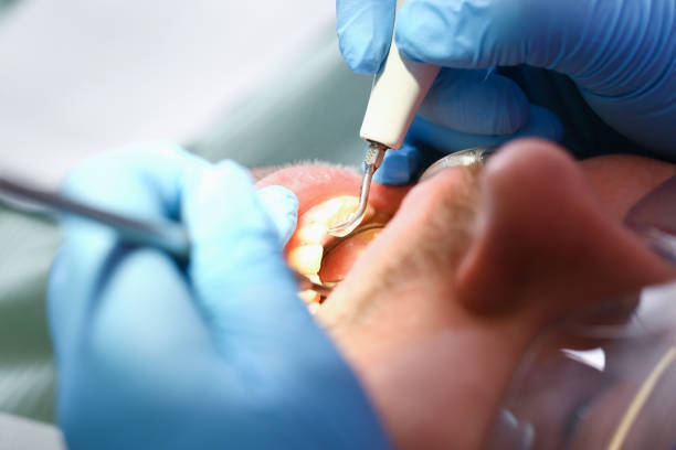 Best Emergency Dental Surgery in Madison, WI