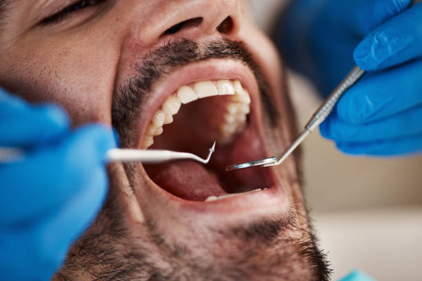 Best Emergency Tooth Extraction in Madison, WI